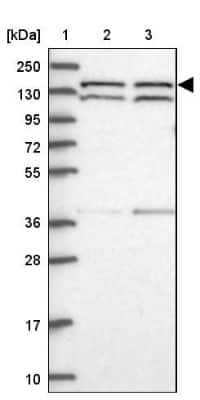 Western Blot: DHX38 Antibody [NBP1-85269]