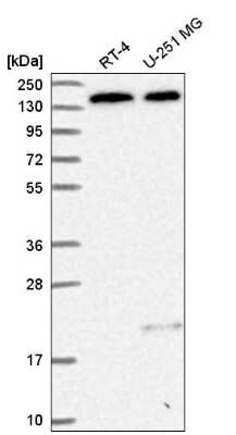 Western Blot: DHX38 Antibody [NBP2-58971]