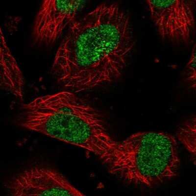 Immunocytochemistry/ Immunofluorescence: DHX40 Antibody [NBP1-91834]