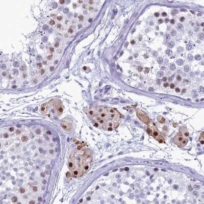 Immunohistochemistry-Paraffin: DHX40 Antibody [NBP1-91834]