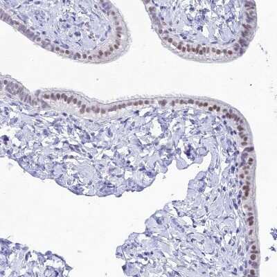 Immunohistochemistry-Paraffin: DHX40 Antibody [NBP1-91834]