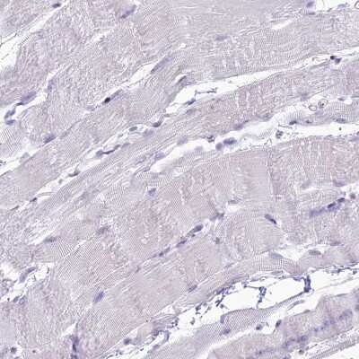 Immunohistochemistry-Paraffin: DHX40 Antibody [NBP1-91834]