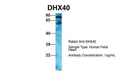 Western Blot: DHX40 Antibody [NBP2-82848]