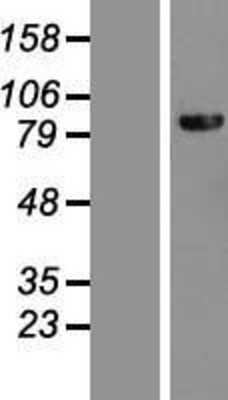 Western Blot: DHX40 Overexpression Lysate [NBL1-09882]