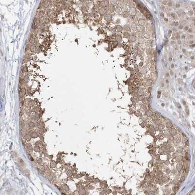 Immunohistochemistry-Paraffin: DHX57 Antibody [NBP1-85267]