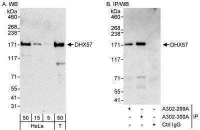 Western Blot: DHX57 Antibody [NBP1-28738]