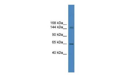 Western Blot: DHX57 Antibody [NBP2-87272]