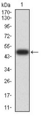 Western Blot: DHX58 Antibody (3E11F1)BSA Free [NBP2-61750]