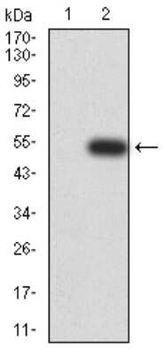 Western Blot: DHX58 Antibody (3E11F1)BSA Free [NBP2-61750]