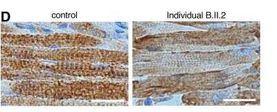 Immunohistochemistry: DHX58 Antibody [NBP1-85348]