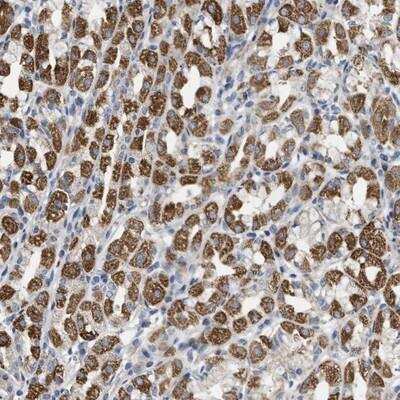 Immunohistochemistry: DHX58 Antibody [NBP1-85349]