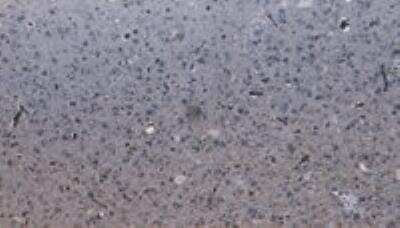 Immunohistochemistry-Paraffin: DHX58 Antibody [NBP1-20939]