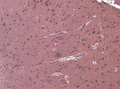 Immunohistochemistry-Paraffin: DHX58 Antibody [NBP1-20939]