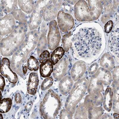 Immunohistochemistry-Paraffin: DHX58 Antibody [NBP1-85348]