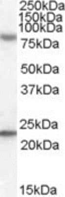 Western Blot: DHX58 Antibody [NBP1-20939]