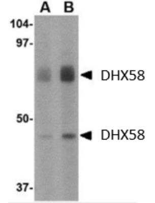 Western Blot: DHX58 AntibodyBSA Free [NBP1-76389]