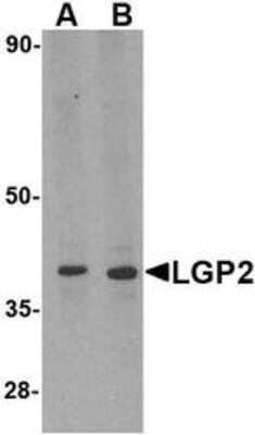 Western Blot: DHX58 AntibodyBSA Free [NBP1-76390]