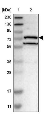Western Blot: DHX58 Antibody [NBP1-85348]