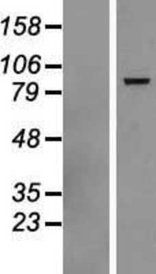 Western Blot: DHX58 Overexpression Lysate [NBP2-06350]