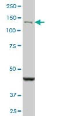 Western Blot: DHX8 Antibody (1D6) [H00001659-M07]