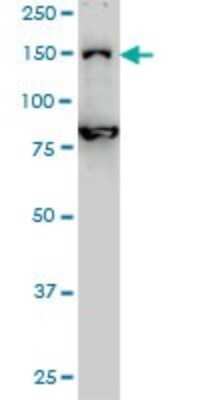 Western Blot: DHX8 Antibody (1E10) [H00001659-M01]