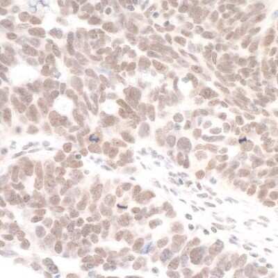 Immunohistochemistry: DHX8 Antibody [NB100-1713]