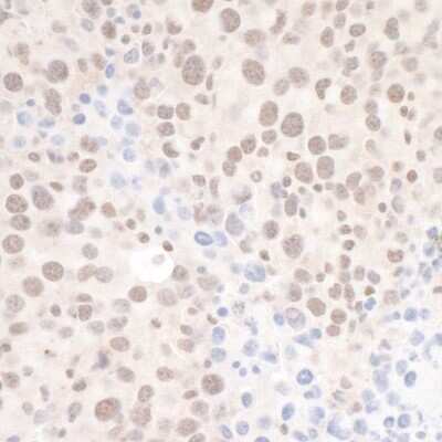 Immunohistochemistry: DHX8 Antibody [NB100-1713]