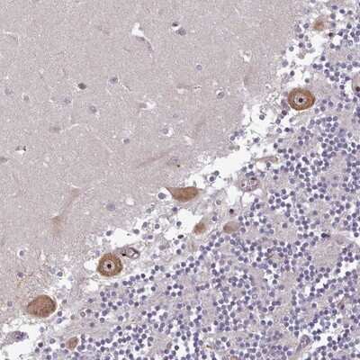 Immunohistochemistry-Paraffin: DHX8 Antibody [NBP2-13923]