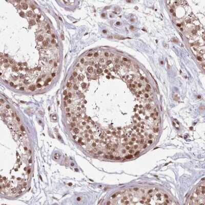 Immunohistochemistry-Paraffin: DHX8 Antibody [NBP2-13923]