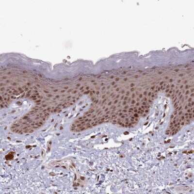 Immunohistochemistry-Paraffin: DHX8 Antibody [NBP2-13923]