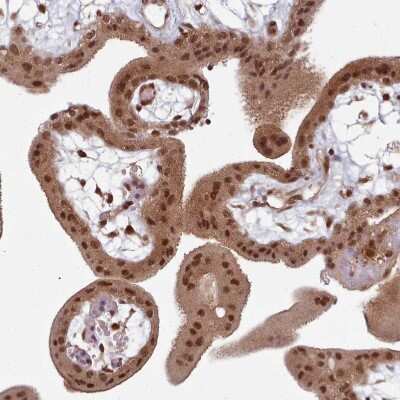Immunohistochemistry-Paraffin: DHX8 Antibody [NBP2-13923]