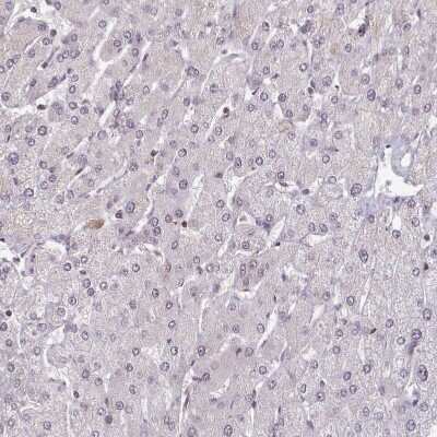 Immunohistochemistry-Paraffin: DHX8 Antibody [NBP2-13923]