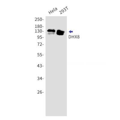 Western Blot: DHX8 Antibody (S04-1I7) [NBP3-15023]