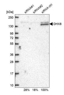 Western Blot: DHX8 Antibody [NBP2-13923]