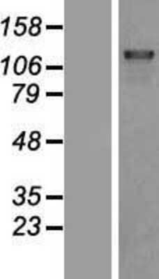 Western Blot: DHX8 Overexpression Lysate [NBP2-07809]