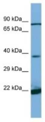 Western Blot: DIA1 Antibody [NBP3-10633]