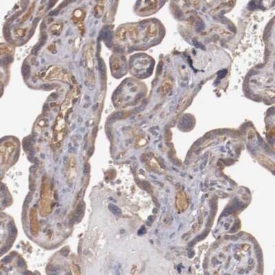 Immunohistochemistry-Paraffin: DIA1R Antibody [NBP1-94010]