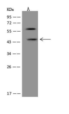 Western Blot: DIA1R Antibody [NBP3-05988]