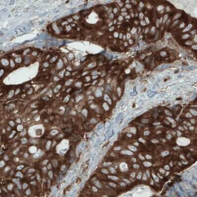 Immunohistochemistry-Paraffin: DIAPH-2 Antibody (CL1111) [NBP2-52966]