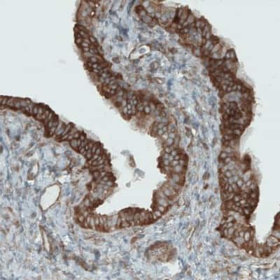 Immunohistochemistry-Paraffin: DIAPH-2 Antibody (CL1111) [NBP2-52966]