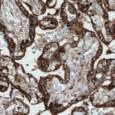 Immunohistochemistry-Paraffin: DIAPH-2 Antibody (CL1111) [NBP2-52966]