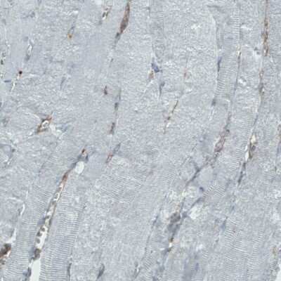 Immunohistochemistry-Paraffin: DIAPH-2 Antibody (CL1111) [NBP2-52966]