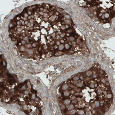 Immunohistochemistry-Paraffin: DIAPH-2 Antibody (CL1111) [NBP2-52966]