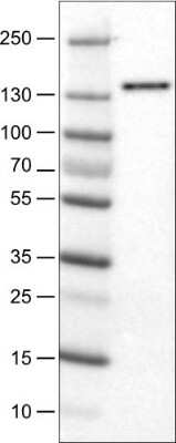 Western Blot: DIAPH-2 Antibody (CL1111) [NBP2-52966]