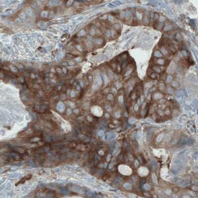 Immunohistochemistry: DIAPH-2 Antibody (CL1113) [NBP2-52967]