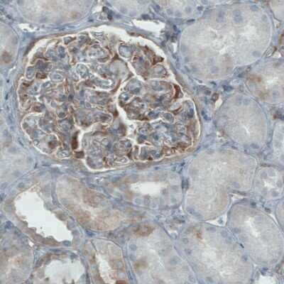 Immunohistochemistry-Paraffin: DIAPH-2 Antibody (CL1113) [NBP2-52967]