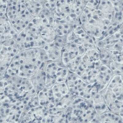 Immunohistochemistry-Paraffin: DIAPH-2 Antibody (CL1113) [NBP2-52967]