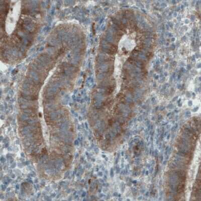 Immunohistochemistry-Paraffin: DIAPH-2 Antibody (CL1113) [NBP2-52967]