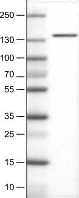 Western Blot: DIAPH-2 Antibody (CL1113) [NBP2-52967]