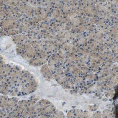 Immunohistochemistry-Paraffin: DIAPH-2 Antibody [NBP1-85217]